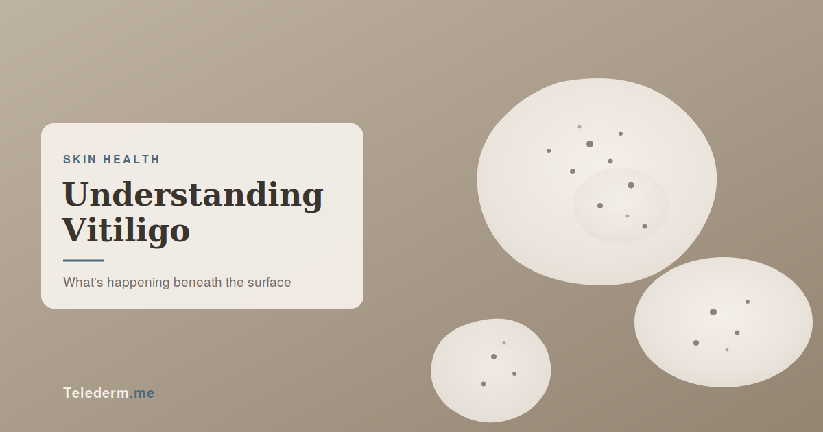vitiligo-header-brand.png