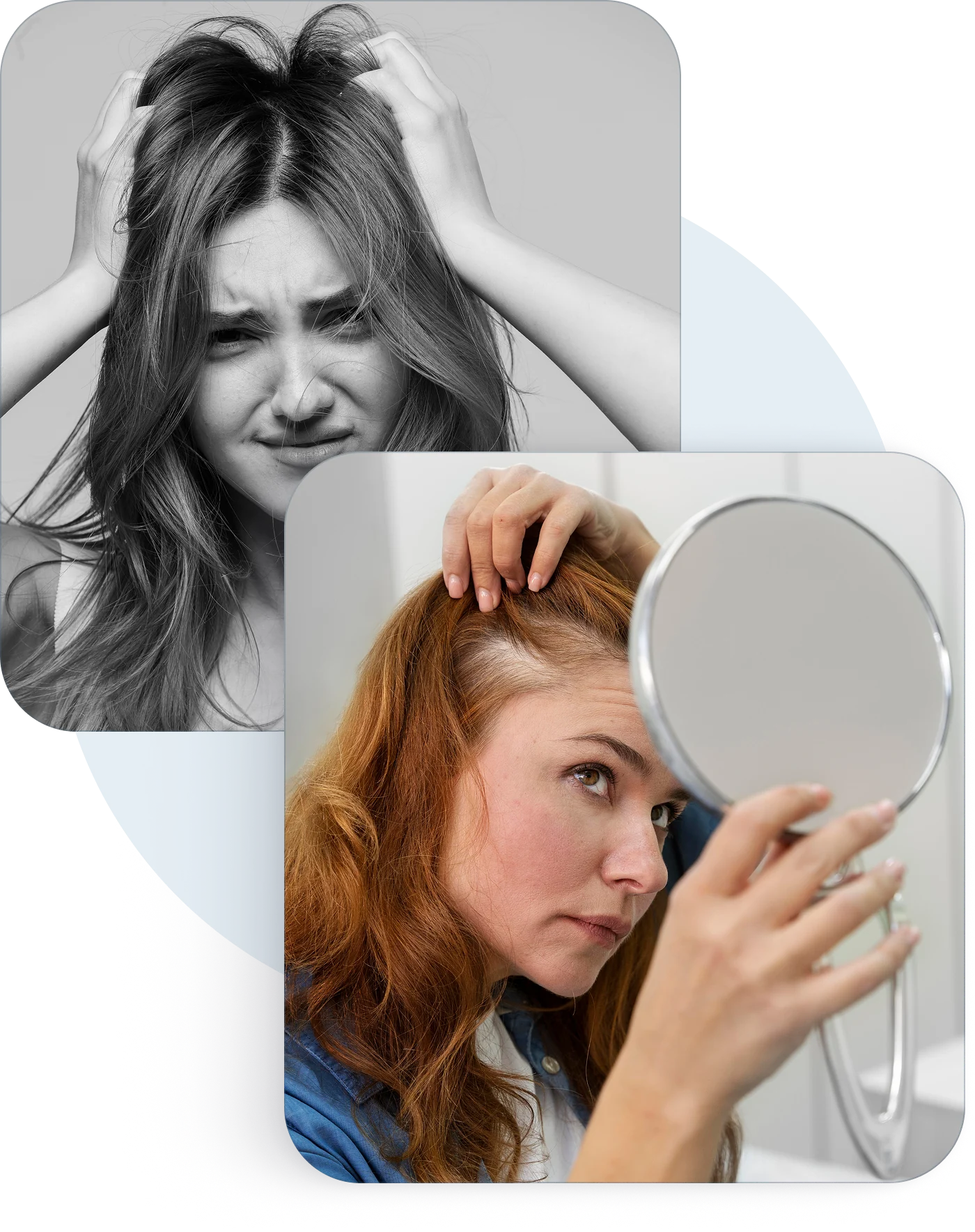 A woman worried about her hair, and a woman checking her hairline in a mirror