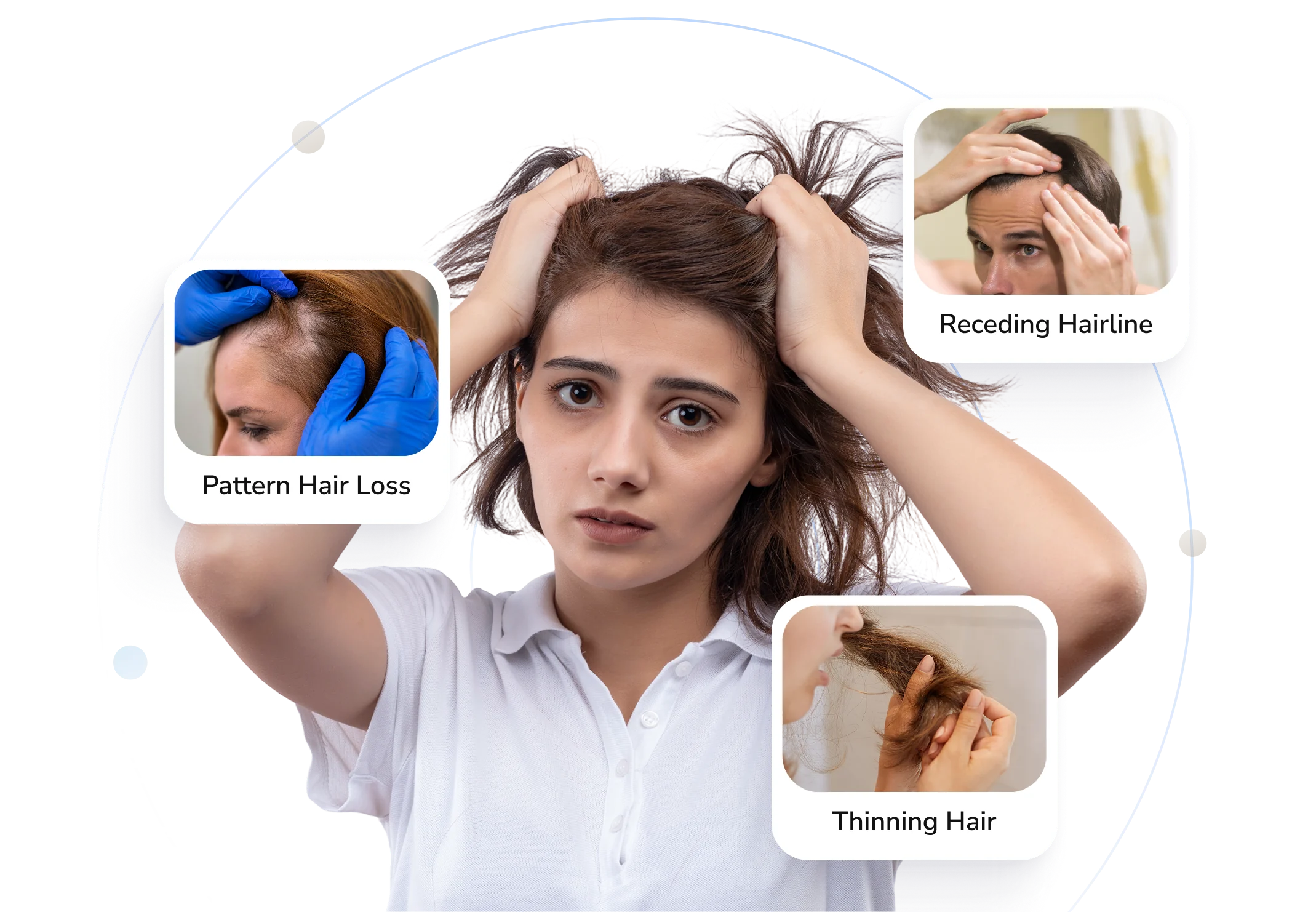 Types of hair loss Telederm helps with — receding hairline, pattern hair loss and thinning hair