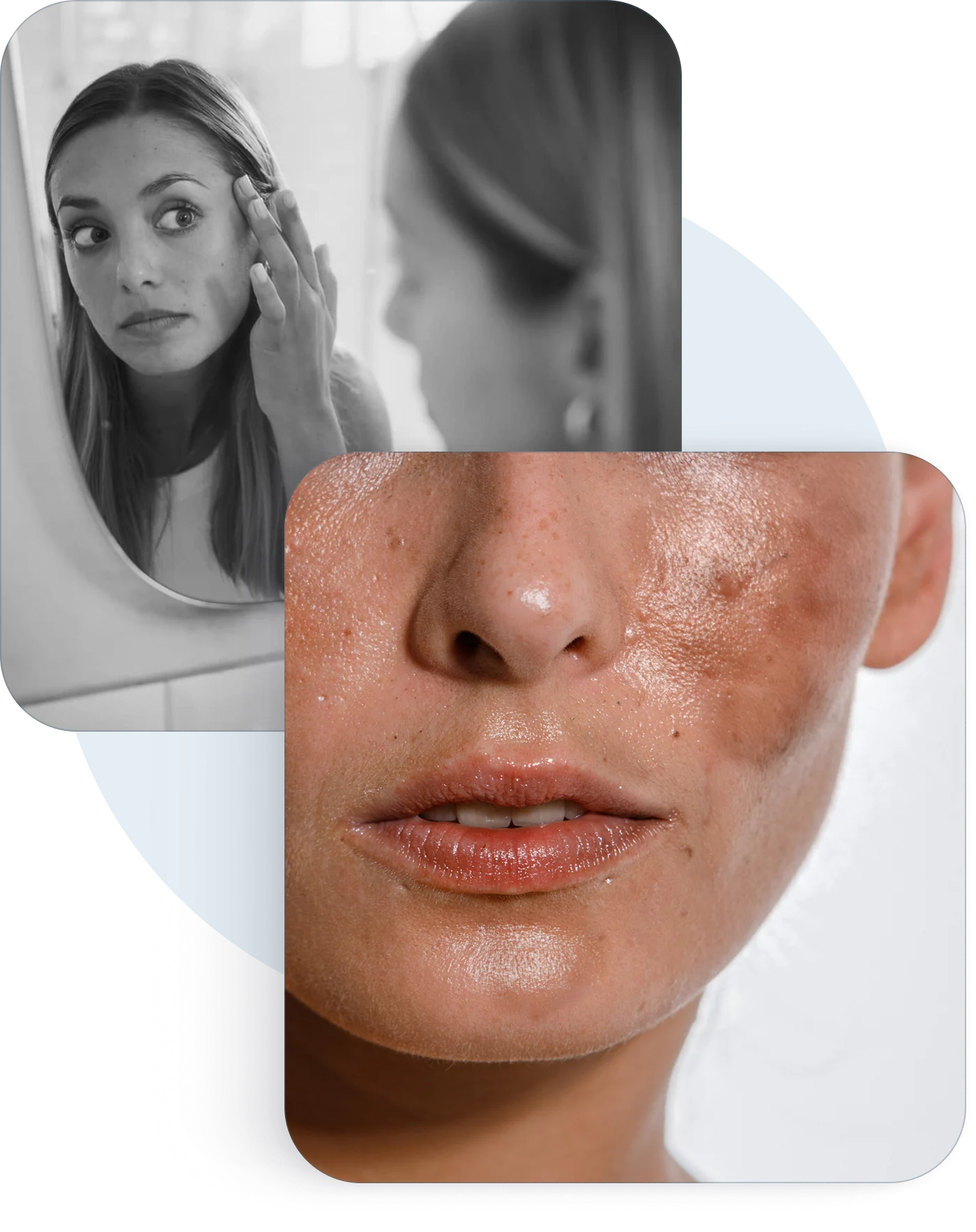 A woman checking dark spots in a mirror, and a close-up of facial pigmentation