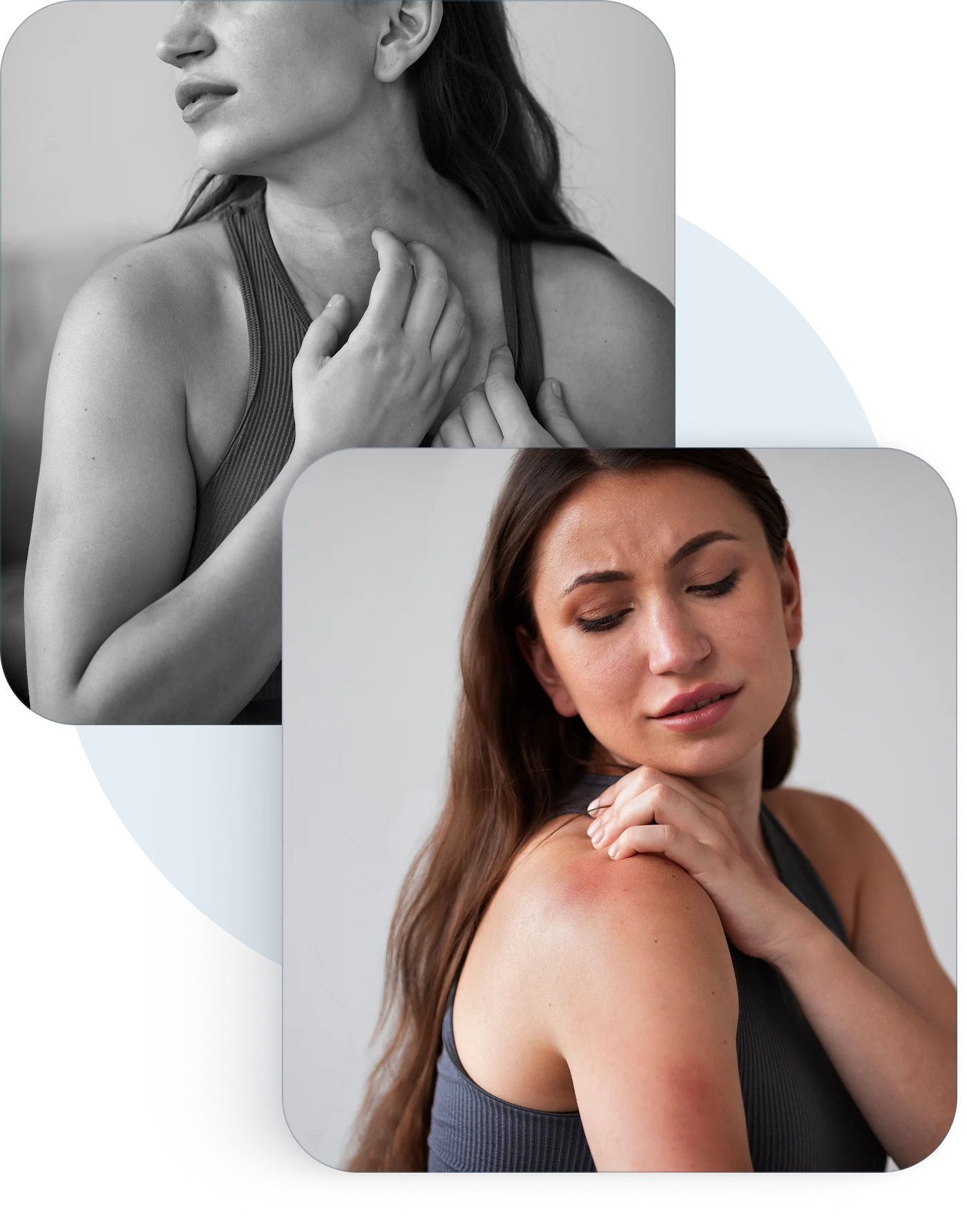 Two women scratching irritated skin on the neck and shoulder