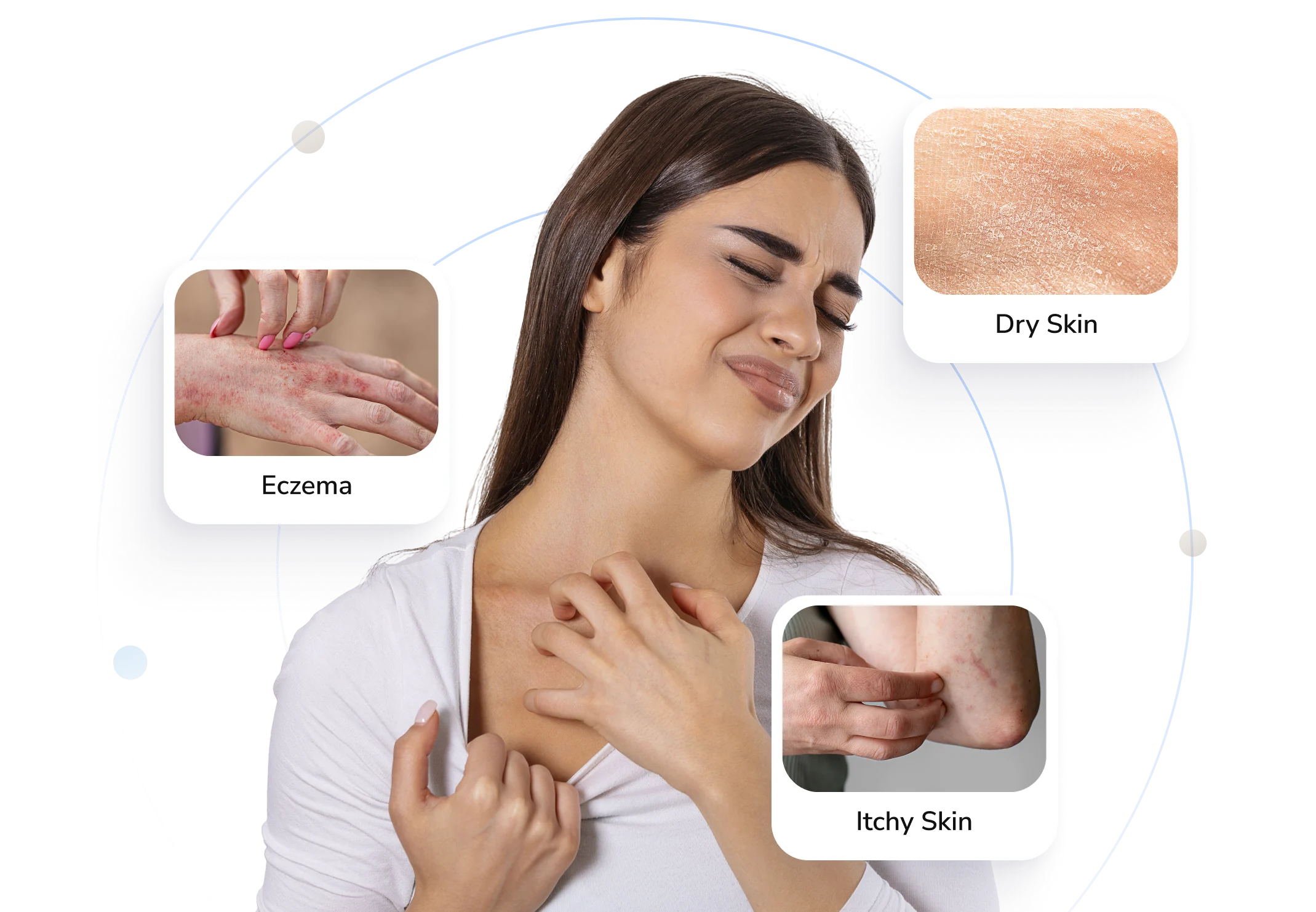 Types of itching Telederm helps with — eczema, dry skin and itchy skin