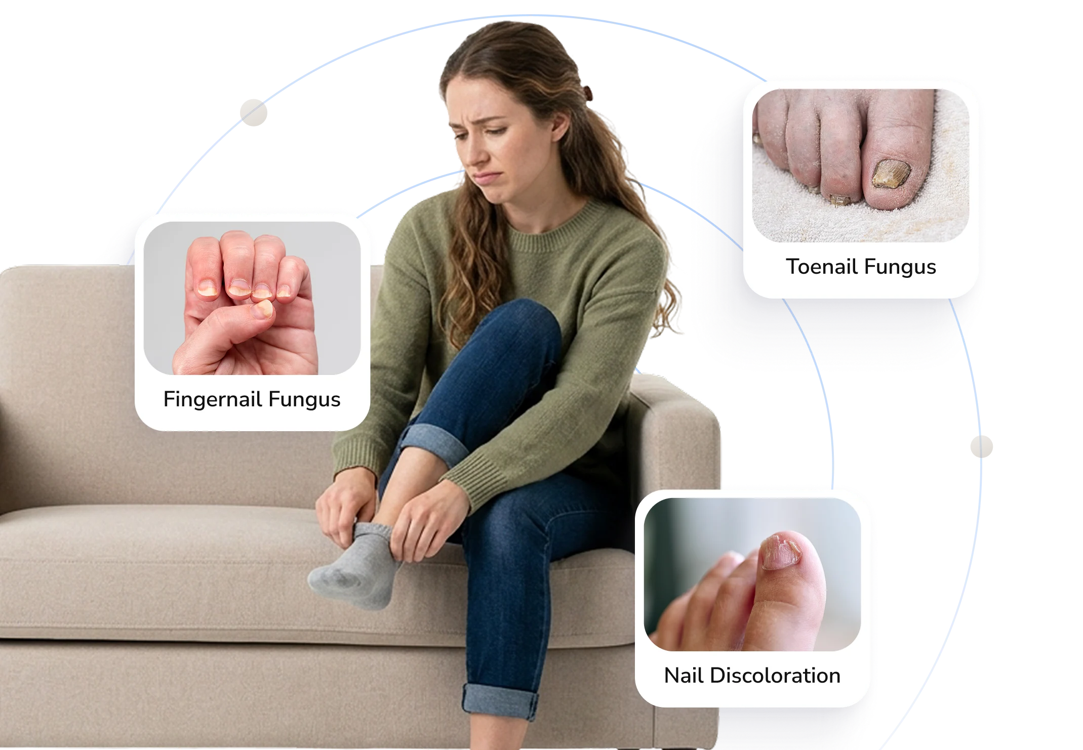 Types of nail fungus Telederm helps with — fingernail fungus, toenail fungus and nail discoloration