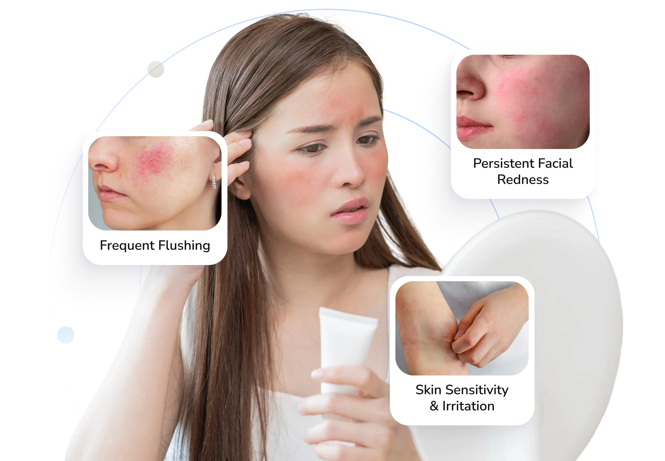 Rosacea symptoms Telederm helps with — flushing, persistent facial redness and skin sensitivity