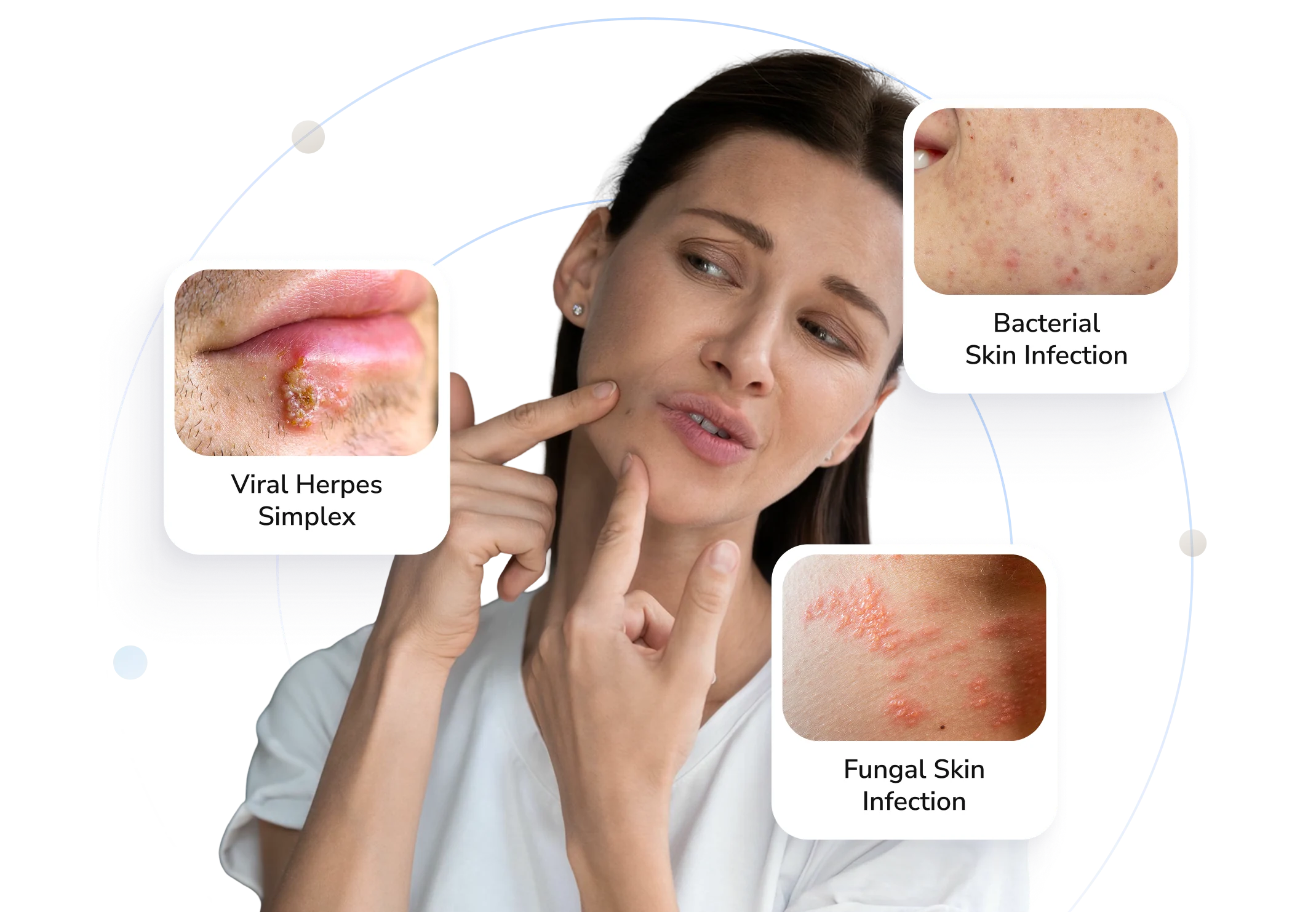 Types of skin infections Telederm helps with — viral, bacterial and fungal