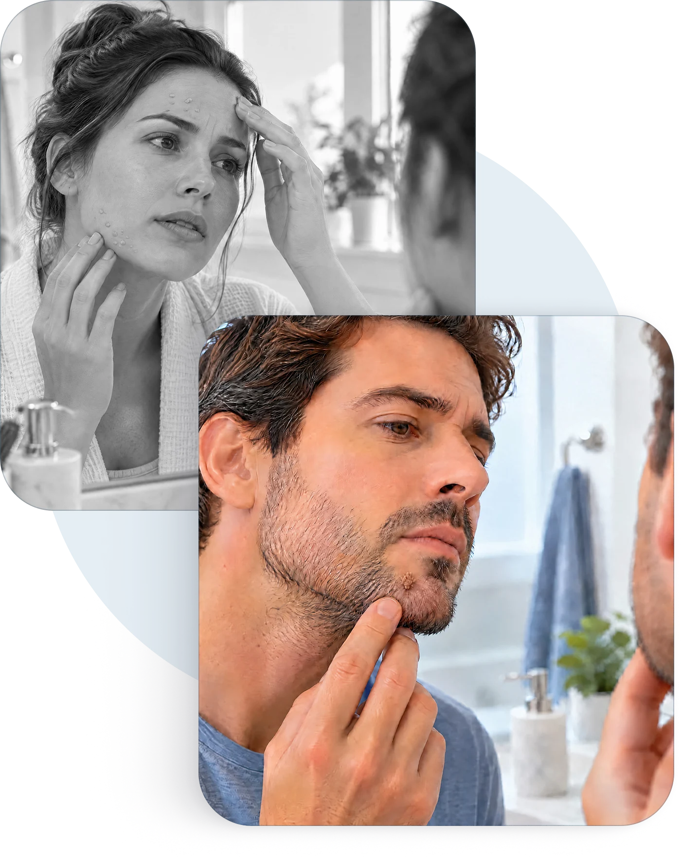 Two people checking a skin growth in the mirror