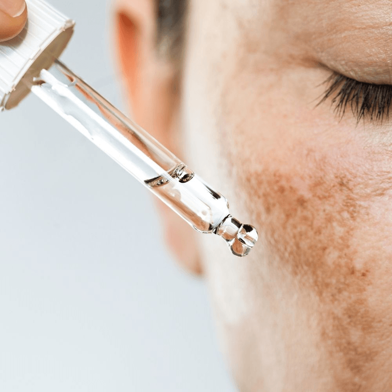 Skin Bleaching image 1