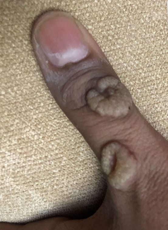 before treatment
